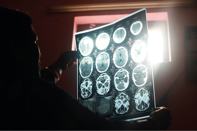 ctscan